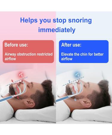 ROOHO Anti-Snoring Mouth Guard - Comfortable & Adjustable Solution for Men/Women - Buy Online on SooperMarket.com