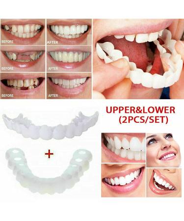 Xindinuo Snap-On Veneer Teeth - 2 Pairs | Instant Dentures for Men & Women for Confident Smile - Buy Online on SooperMarket.com