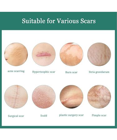 Jopwkuin Scar Care Cream | Scar Removal & Wrinkle Reduction for Women - Ideal for Surgery Scars - Buy Online on SooperMarket.com