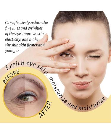 Rollerball Castor Oil & Frankincense Eye Roller | Reduce Dark Circles & Bags Under Eyes - International Shipping - Buy Online on SooperMarket.com