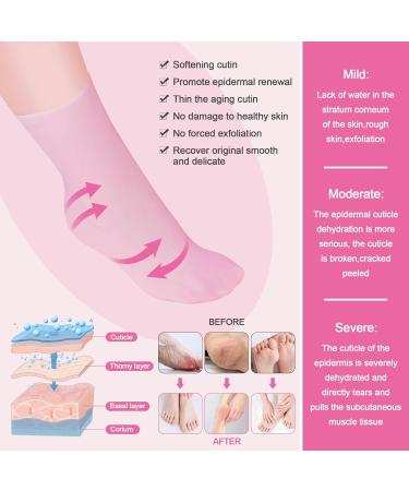 Foot Peel Mask Skin So Soft Foot Mask DYKOOK 1 Pair of Silicone Moisturising Socks Feet Hard Skin Remover Foot Care Footmask Socks Foot Spa Socks for Dry Feet Hard Skin Cracked Heel Dry Skin(S) - Buy Online on SooperMarket.com