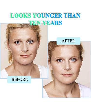 Face Moisturiser 2.5% Retinol Serum High Strength for Face Retinol Face Serum with Hyaluronic Acid Vitamin E Anti Ageing Anti Wrinkle Serum Reduces Enlarged Pores Refines and Softens Skin - Buy Online on SooperMarket.com