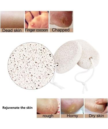 Pumice Stone for Feet Callus (2 PCS) - Pinowu Foot Scrub Exfoliation | Remove Dead Skin Naturally - Buy Online on SooperMarket.com