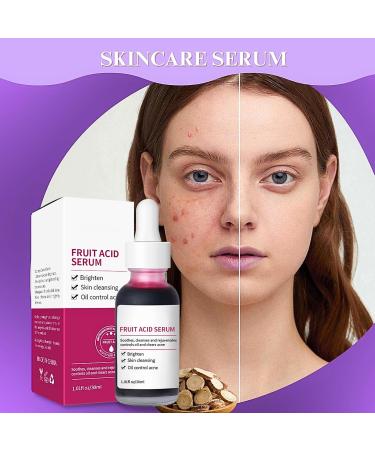Niacinamide Serum With Fruit Acid Korean Serum Reduces Redness Hydrating Serum Improve Blemishes Dark Spot Correcting Glow Serum Brightening Serum For All Skin Type Serums Skincare - Buy Online on SooperMarket.com