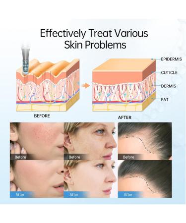 Dr.pen M8 Microneedling Pen Wireless Professional Micro Needling Pen Skin Care Tool Kit for Face and Body Auto Microneedling Device Set for Face 6 Speeds with 10 Nano Round Cartridges (UK Plug) - Buy Online on SooperMarket.com