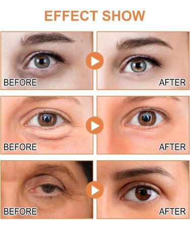 Vitamin C Eye Cream For Dark Circles Vitamin C Eye Cream Anti Aging Vitamin C Brightening Eye Cream For Brighten Skin Around the Eyes Eye Cream Targets Fatigue Dullness And Crow'S Feet - Buy Online on SooperMarket.com