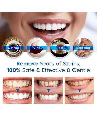 Teeth Whitening Pen Set Fast & Effective Whitening Gel for Sensitive Teeth | 3 PCs to Remove Stains & Reduce Yellowing - Buy Online on SooperMarket.com