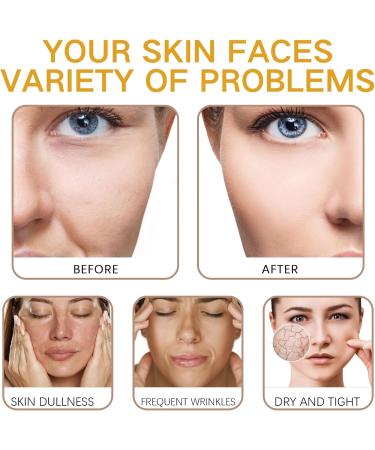 Turmeric Face Cream Skin Lightening Cream Face Moisturiser Anti Wrinkle Face Cream Dark Spot Cream Deep Hydrating Skin Brightening Radiant & Glowing Skin Repairing Face Care - Buy Online on SooperMarket.com