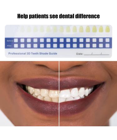 Professional Tooth Whitening Color Guide - 5-Part Comparison Card for Home & Dental Use - Buy Online on SooperMarket.com