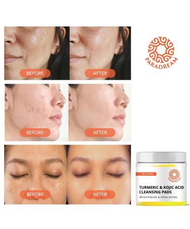Turmeric Kojic Cleansing Pads - Exfoliating Face Pads for Acne Scars & Pore Cleaning - 50PCS | Skin Firming & Deep Clean - Buy Online on SooperMarket.com