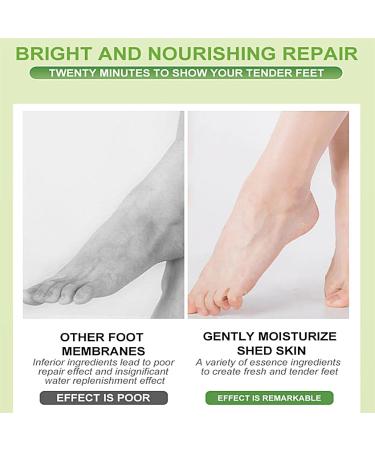 Moisturizing Foot Mask - 5 Pairs Exfoliating Peeling Socks for Dry Cracked Feet - Foot Spa Treatment for Men & Women - Buy Online on SooperMarket.com
