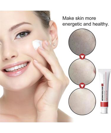 Age Spot Remover for Face Dark Spot Remover for Face & Body Spot Cream Dark Spot Corrector Freckle Remover Cream Hyperpigmentation Treatment Formulated with Nicotinamide Vitamin E Glycerol - Buy Online on SooperMarket.com