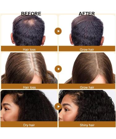 Go Ho Batana Oil for Hair Growth(50ml) Hair Growth Serum Hair Growth Oil with Castor Oil Coconut Oil for Women and Men Moisturizing & Strengthening Serum for Scalp & Hair Care - Buy Online on SooperMarket.com
