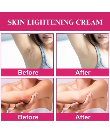 Trendyfave Underarm Brightening Cream - Smelly Remover Cream For For Dark Armpit Body Cream For Skin Moisturizing Dark Armpits Remover For Intimate Areas Dark Elbow Remover - Buy Online on SooperMarket.com