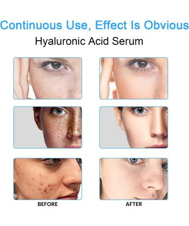 Face Serum Hyaluronic Acid Serum Skincare Serum Hyaluronic Acid Collagen Serum For Face Face Serum For Women & Men To Plump And Smooth Skin All Skin Types Skin Care. - Buy Online on SooperMarket.com