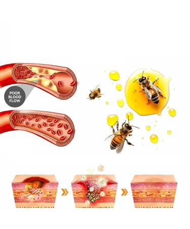 FROPUN Bee Venom Treatment Cream | Acne & Skin Repair | Hydrating Cream for Men & Women | 1 Fl Oz - Buy Online on SooperMarket.com