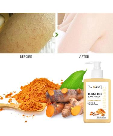 FAYNDE Turricum Body Cream 100ml - Nourishing Daily Skin Care with Ginger Extract for Women & Teens | Ideal for Back Neck Shoulders Arms & Legs - Buy Online on SooperMarket.com