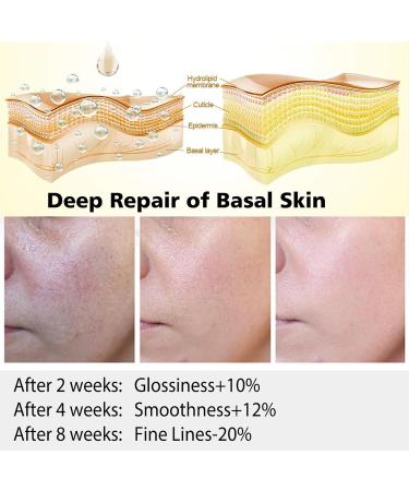 Retinol Serum High Strength Anti-aging Serum with Hyaluronic Acid & Vitamin E Face Serum for Wrinkles Pigmentation Fine Lines & Sensitive Skin.1Oz - Buy Online on SooperMarket.com