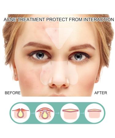 Gentle Solution for Stain Removal | 132 Pimple Spot Treatment for Smooth Skin - Buy Online on SooperMarket.com