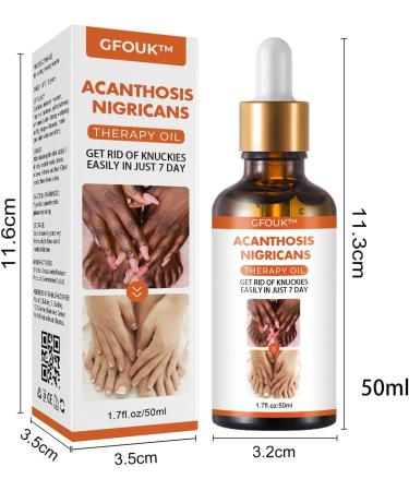 Skin Bleaching Serums | Dark Skin Permanent Whitening Lightening | Armpit Bleaching Serums for Women Supercharged Face Serums Skin Lightening Bleaching Oil Black Spot Corrector Remover for Face 2Pcs - Buy Online on SooperMarket.com