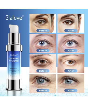 Retinol Eye Cream for Bags, Wrinkles & Dark Circles | Anti-Aging Serum 15ML - Buy Online on SooperMarket.com