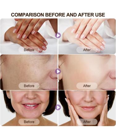 Niacinamide Serum Serum B5 Vitamin B3 Serum Anti-Wrinkle Serum for a Radiant Skin Tone and Minimised Pores Against the First Signs of Skin Ageing - Buy Online on SooperMarket.com