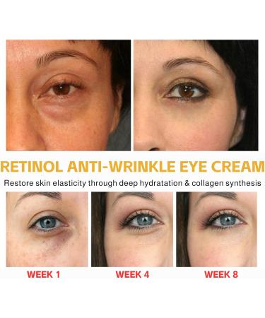 Retinol Eye Cream Retinol Peptide Anti Wrinkle Eye Cream Anti Aging Eye Cream for Dark Circles and Puffy Eyes Under Eye Cream for Women/Men Skincare Fine Lines Improve Skin Tone 30g - Buy Online on SooperMarket.com