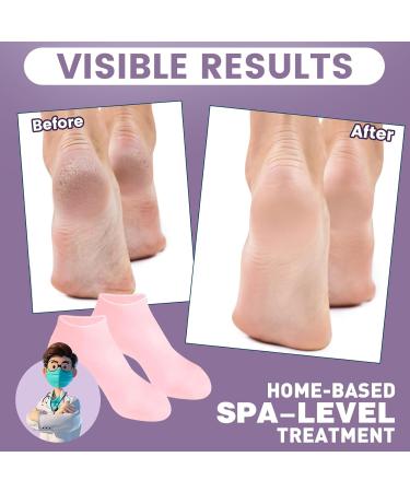 Buy 5 Pairs Silicone Socks for Cracked Feet | Moisturizing Foot Care | Fits Size S/M | Assorted Colors - Buy Online on SooperMarket.com