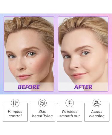 Beauty Star Facial Wand Machine - Violet Portable Beauty Device for Women/Men - Buy Online on SooperMarket.com
