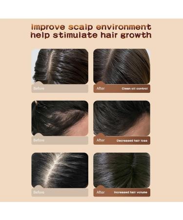 Hair Growth Shampoo with Biotin & Castor Oil | Anti Hair Loss & Hair Thickening | Strengthen & Restore Damaged Hair - 11.8 oz - Buy Online on SooperMarket.com
