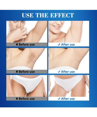Kojic Acid Skin Whitening Cream for Body Underarm Cream Lightening Cream for Intimate Areas and Bleaching for Body Underarms Armpit Knees Legs and Inner Thigh Cream Anal Lightening Cream - Buy Online on SooperMarket.com