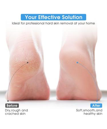 Rechargeable Foot File Portable Electronic Foot File Pedicure Tools Electric Feet Callus Remover Rechargeable Automatic Foot File Pedicure Tool for Dead Skin - Buy Online on SooperMarket.com