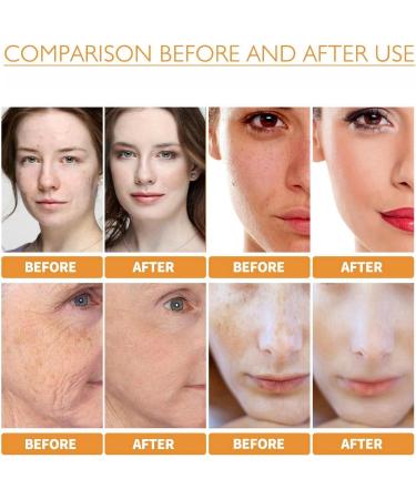 Tallow Honey Balm Tallow Moisturizer Firming Face Cream Tallow Face Cream Tallow Balm Instant Wrinkle Remover Tallow And Honey Balm Repair Barrier Face & Body Moisturiser For Dry Skin 30g - Buy Online on SooperMarket.com