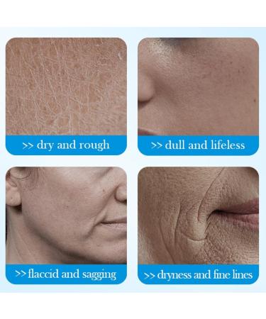 Hyaluronic Acid Anti-Wrinkle Cream Hyaluronic Acid Moisturiser Face Women & Men Anti Aging Face Cream Face Moisturiser For Mature & Young Skin Hydrate Smooth Dry Skin - Buy Online on SooperMarket.com