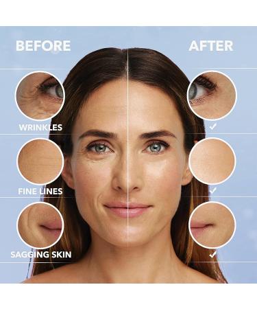 Argireline Solution 10% Anti Wrinkle Serum - Anti Aging Serum for Face Argireline Serum - Deep Wrinkle Reducer Anti Aging Promote Collagen Peptides Serum for a Revitalized Youthful Glow - Buy Online on SooperMarket.com