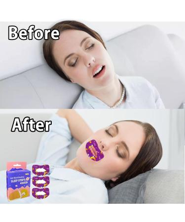 Mouth Tape For Sleeping Quit Mouth Breathing Reduce Snoring Non Woven Fabric Large Size For Adults (30 Sheets For 30Days Supply) - Buy Online on SooperMarket.com