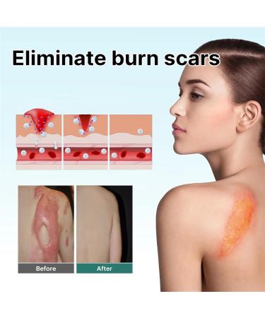 CRusio Awzlove Ampoule Scar Removal Serum - Remove New Scars in 3 Weeks, Old Scars in 6 Weeks (1pcs) - Buy Online on SooperMarket.com