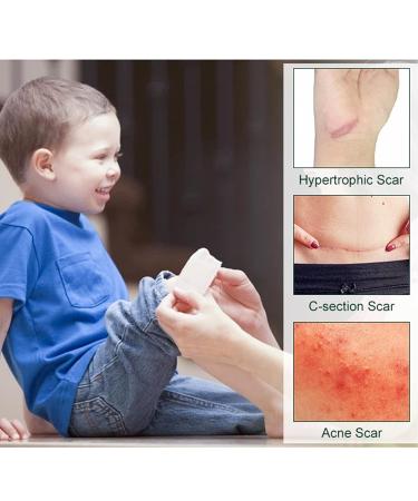 Moisturizing Silicone Scar Tape Roll - Grade Painless Scar Sheets for Repairing Scars - Buy Online on SooperMarket.com