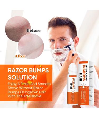 Ingrown Hair Treatment & Razor Bumps Stopper Serum - Alcohol-Free After Shave Solution for Men and Women - Face, Neck, Bikini, Legs, and Underarms - Buy Online on SooperMarket.com