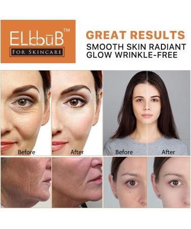 Premium 20% Vitamin C Serum For Face with Hyaluronic Acid Retinol & Amino Acids - Boost Skin Collagen Brighten Hydrate & Plump Skin Anti Aging & Wrinkle Facial Serum 30 ml (Pack of 1) - Buy Online on SooperMarket.com