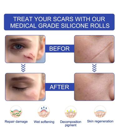 Breathable Scar Sheet Roll - 3 Meter Wide Tape for Scar Protection - Buy Online on SooperMarket.com