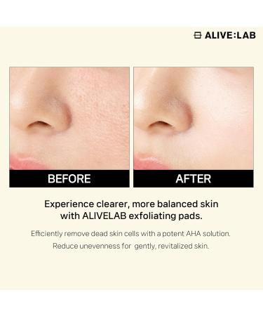 ALIVELAB Cotton Candy Ball Exfoliating Pads - Salicylic Acid Facial Peels for Blackheads & Dead Skin Soothing Acne Treatment (1.69 fl. oz) - International Shipping Available - Buy Online on SooperMarket.com