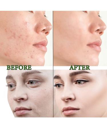 Moisturizing Green Tea Mask Stick | Deep Pore Cleansing & Oil Control | Hydrating Face Mask for All Skin Types - Buy Online on SooperMarket.com
