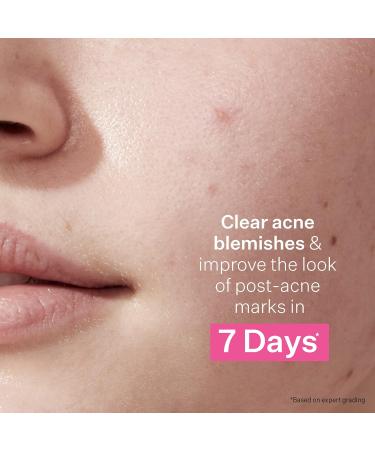 StriVectin Multi Action Clear Acne Treatment Set | 30-Day Trial Kit for Clearer Smoother Skin | Blemish Control & Breakout Defense - Buy Online on SooperMarket.com