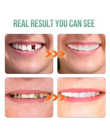 2 PCS Fake Teeth Veneers for Temporary Tooth Repair - Men and Women | Dental Veneers for Upper and Lower Jaw | Regain a Confident Smile with Bright White Results - Buy Online on SooperMarket.com