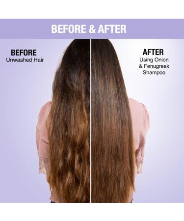 Buy Nykaa Naturals Anti-Dandruff Shampoo - Hair Growth & Gentle Cleanser with Onion & Fenugreek - 0.67 oz - International Shipping Available - Buy Online on SooperMarket.com