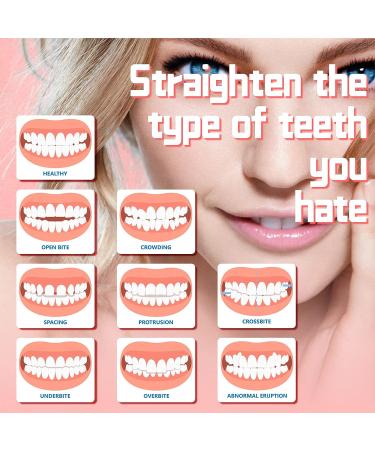 6 PCS Fake Teeth Veneers for Temporary Tooth Repair - Upper and Lower Jaw - Dental Veneers for Men and Women - Bright White Smile - W04 - Buy Online on SooperMarket.com