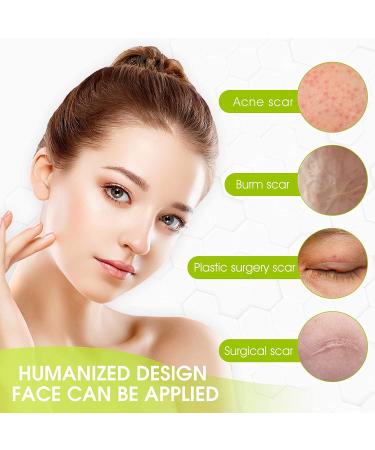 Soft Silicone Scar Tape Roll 1.6x 120 (8 Month Supply) | Reusable & Effective Scar Removal for C-Section, Keloid Surgery, Burn & Acne - Buy Online on SooperMarket.com
