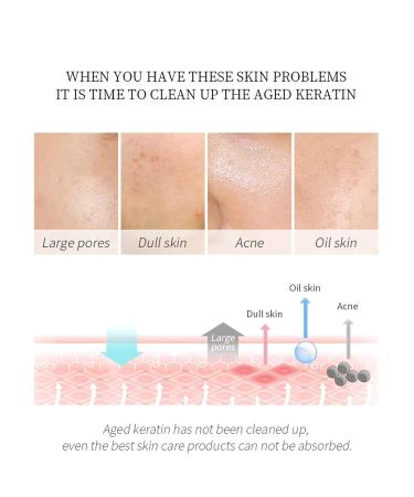 Chamomile Exfoliating Gel - Deep Cleansing Pore Tightening & Hydrating (60g) | Gentle Exfoliation for Improved Skin Tone - Buy Online on SooperMarket.com