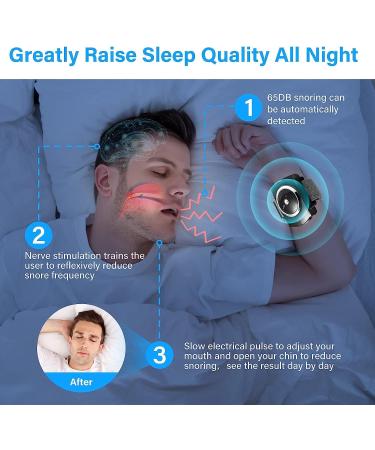 Sleep Connection Anti-Snore Wristband - Effective Snoring Solution for Blocked Nostrils - Snore Reduction - 1 Count (Black) - Buy Online on SooperMarket.com